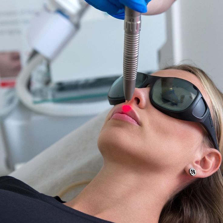 Diode Upper Lip/Chin