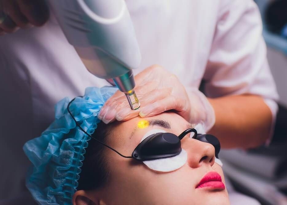 Eyebrow Tattoo Removal